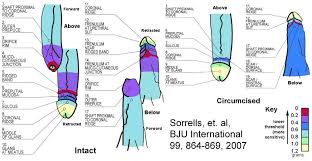 Sorrells Chart The Sorrells Study Graphs The Areas Of Sensitivity In The Circumcised And Intact Male The Areas In Purple And Red Are The Most Circumcision Psychological Well Being Gentle Parenting