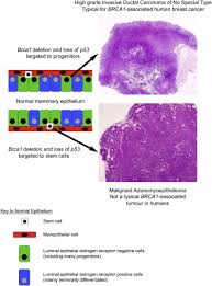 Cancer, meaning crab in latin, is the name of a constellation beneath which the tropic of cancer once was directly located. Brca1 Basal Like Breast Cancers Originate From Luminal Epithelial Progenitors And Not From Basal Stem Cells Sciencedirect