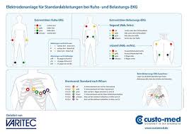 Im regelfall lassen sie diese elektroden beim arzt anlegen und tragen sie 24 stunden lang. Varitec Ag On Twitter Medizintechnik Wie Lege Ich Ein Ekg Richtig An Im Link Finden Sie Ein Schaubild Der Elektrodenanlage Im Ruhe Ekg Und Fur Belastungs Ekg Jeweils Sitzend Als Auch Liegend Https T Co Llltsdjy1c Https T Co K9fr8liq5p