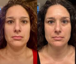 Importance of Skincare Routine for Self-care and Product Effectiveness