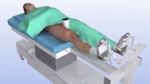 Hip Arthroscopy A Minimally Invasive Hip Scope Procedure
