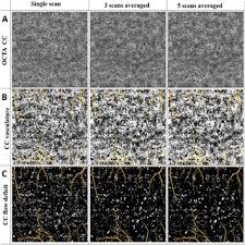 It is equal to a millilitre (ml). Power Spectrum Analysis Of The Inter Capillary Distance For Macular Cc Download Scientific Diagram