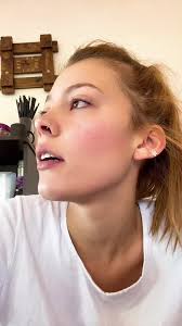 Orzuelo en el Orto: Causas y Remedios