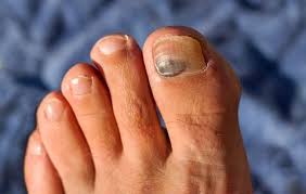Maybe you would like to learn more about one of these? Weird Things That Can Happen To Your Toenails And Feet Women S Health