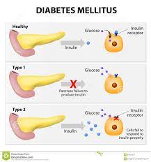 9 tanda macam mana nak tau kencing manis tak terkawal: Tanda Gejala Diabetes Mellitus Pendidikan Pesakit