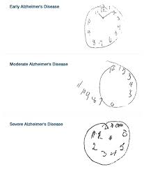 Image result for Clock Drawing Test