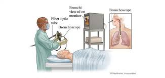 On the top of the page i my broncoscopy (i never know how to spell!) on may 27th. Bronchoscopy