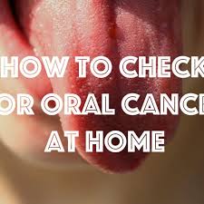 The mouth is one of the most complicated parts of our bodies and the hard palate does not make an exception from that rule. How To Check For Mouth Cancer At Home Healthproadvice