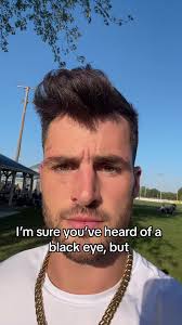 I swear, the ears get the worst of it at #rugby #kcboys #thekcboys  #kansascity #kcmo #kc