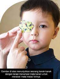 Apa penyebab sakit mata pada kucing? Memelihara Kesihatan Mata Anak Anda Positive Parenting