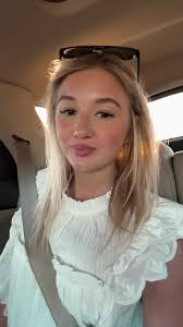 Peep the sun burn! ☀️🌊⛱️🐚