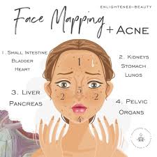 Image result for acne face