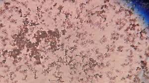 Amorphos Phosphate Crystal Youtube