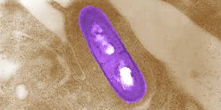 Learn about listeria, a germ that can contaminate food and cause an infection called listeriosis. Listeria Monocytogenes Compare Europe