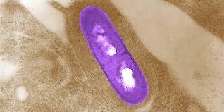 Listeria infection is a foodborne bacterial illness that can be very serious for pregnant women, people older than 65 and healthy people rarely become ill from listeria infection, but the disease can be. Listeria Monocytogenes Compare Europe