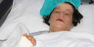 مهندس يضرب زوجته بقطعة حديدية ويخلع أسنانها Elmarada