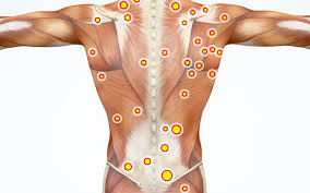 Check spelling or type a new query. Everything You Need To Know About Trigger Point Therapy Massage Alternative Therapy Center Massage Therapist