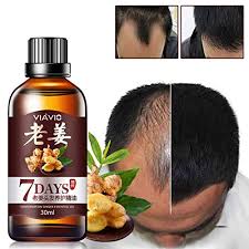Almond oil's impact on the hair growth cycle as seen in rats. Oyalaiy Hair Growth Serum Hair Growth Essential Oil Hair Oil For Hair Growt Hair Growth Hair Thickening Nourishing Essences For Hair Care Hair Care Product For Men Women Amazon De Beauty