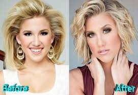 Savannah Chrisley Keeps Millions Of Youth Glued To Her Ig However There Is An Interesting Gossip About Celebrity Plastic Surgery Plastic Surgery Beauty Hacks
