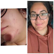 Discounted facial balm by Townes Organics