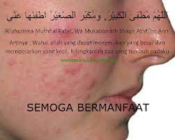 Doa Untuk Menghilangkan Jerawat Bincang Santri