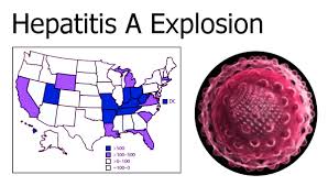 Hepatitis means inflammation of the liver. Researchers Say Vaccinations Could Stamp Out Hepatitis A Outbreaks Food Safety News