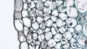 Image result for Collenchyma Cells: -"