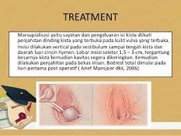 We did not find results for: Kista Bartholini