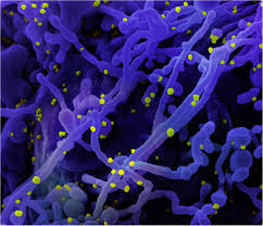 The nimbus is calibrated to mist the saline solution in 10 micron droplets. Nasal Spray Covid 19 Vaccine Shows Promising Results In Mice