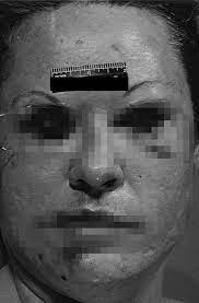 He is incarcerated in the john montford psychiatric unit in lubbock, texas. Eyeball Killer Charles Albright Rare Crime Scene Photos Crime News