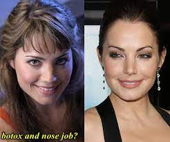 Erica durance plastic surgery may not be the first one among the actresses but based on her popularity it is quite a story. Erica Durance Plastic Surgery Plastic Surgery Hits