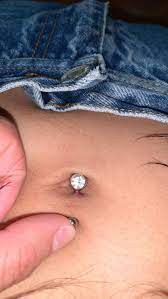 Is This The Start Of A Keloid On A Navel Piercing And How Do I Make It Go Away Noticed It Today Pierced On Feb 4th 2021 With No Prior Healing Issues