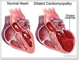 หัวใจโต (cardiomegaly) ไม่ใช่โรค แต่เป็นภาวะที่หัวใจมีขนาดใหญ่หรือหนากว่าปกติ สาเหตุส่วนใหญ่มาจาก ความดันโลหิตสูงหรือโรคหลอดเลือดหัวใจ และสาเหตุ. à¸™ à¸­à¸‡à¸«à¸¡à¸²à¸ž à¸™à¸˜ à¹ƒà¸«à¸ à¸ à¸š à¹‚à¸£à¸„à¸à¸¥ à¸²à¸¡à¹€à¸™ à¸­à¸« à¸§à¹ƒà¸ˆà¹€à¸ª à¸­à¸¡à¹à¸šà¸šà¸žà¸­à¸‡à¸‚à¸¢à¸²à¸¢ Dogilike Com