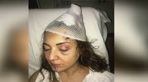 Caso Abril Pérez: desaparece el exesposo que la golpeó y el juez que lo  dejó en libertad no es sancionado