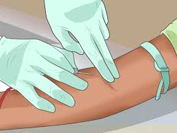 Hiv Symptome Erkennen Wikihow