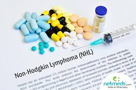 Symptoms, causes, diagnosis, treatment, and prevention. Non Hodgkin S Lymphoma Causes Symptoms And Treatment