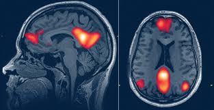 Image result for Hypnosis