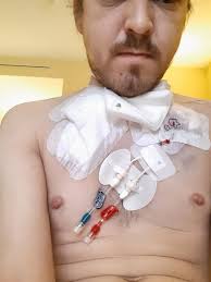 Well, going under the knife again. I found out they need to put in a bigger  catheter in! Pray this will last 3 months! Ko9