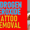 How to remove a stick and poke tattoo. Https Encrypted Tbn0 Gstatic Com Images Q Tbn And9gcsnol4lukr8h8lpb5mmcb6m1roqao2v9mpwhe3e B4pt2ply9dx Usqp Cau
