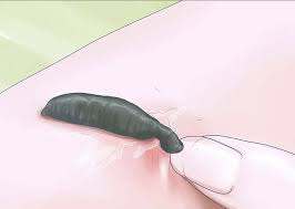 This will allow the chlorine to dissipate out of the water, which can kill leeches. Quick Guide To Leeches And How To Deal With Them Survivalkit Com
