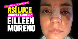 Actriz, presentadora, productora y escritora mi hobbie capturar momentos @lonelylookingsky mánager @tn_management www.petruma.com. Asi Esta Eileen Moreno Un Ano Despues De La Agresion De Su Novio