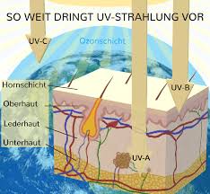 Hautkrebserkrankungen, besonders der schwarze hautkrebs (maligne melanom), haben weltweit dramatisch zugenommen. Unter Uv Strahlung