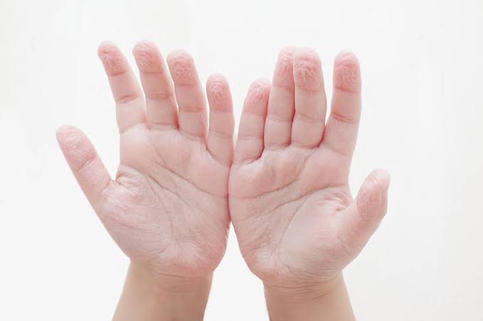 Do you know why fingers shrivel when they are in water for a long time? It's  the opposite of what most people think