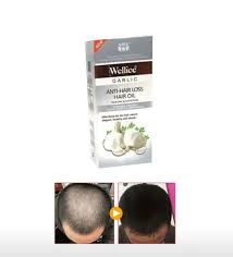 Scientists have found four antioxidant effects of aged garlic extract ( 11 ): Wellice Garlic Anti Hair Loss Hair Oil 120ml Made In India Buy Online At Best Prices In Pakistan Daraz Pk