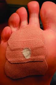 Salicylic acid ultra cleansing mask ice cream mask 3bags. Salicylic Acid Applied Through An Apertured Mask To Prevent Lateral Download Scientific Diagram