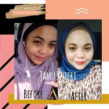 JamuPuteri LadyCute Setapak