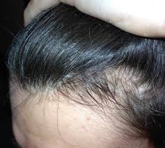 Pin On Hair Ensure