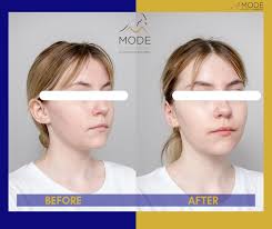Mode Plastic Surgery