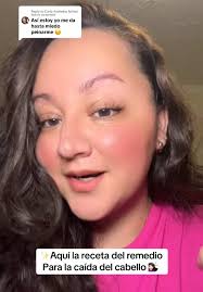 Remedy for Hair Loss: Effective Treatment Tips