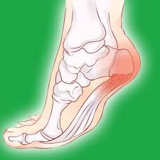 17 отметок «нравится», 2 комментариев — ligament pro (@ligament.pro) в instagram: Sp Produk Sakit Kaki Clear Herbs